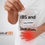 IBS and gallstones