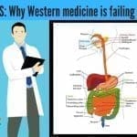 IBS and western medicine